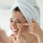 Did you know that the main cause of your acne is most likely stress? Essential tips from a expert